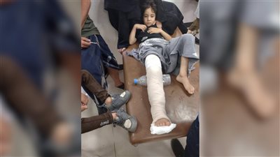 إصابة شاب وابن أخيه برصاص قناص حوثي بتعز اليمنية 